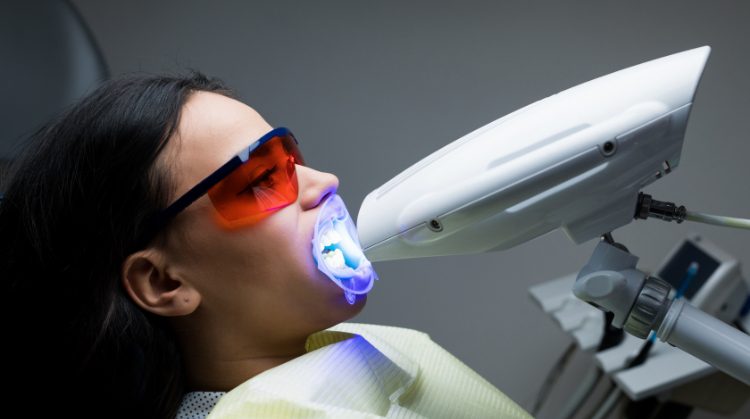 Common Dental Procedures: Safe and effective LED teeth whitening for a brighter smile.