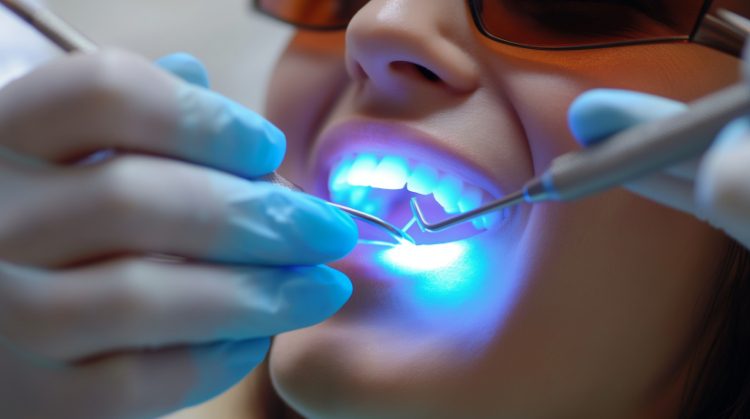 Cosmetic Dentistry Treatment with curing light during a dental procedure.